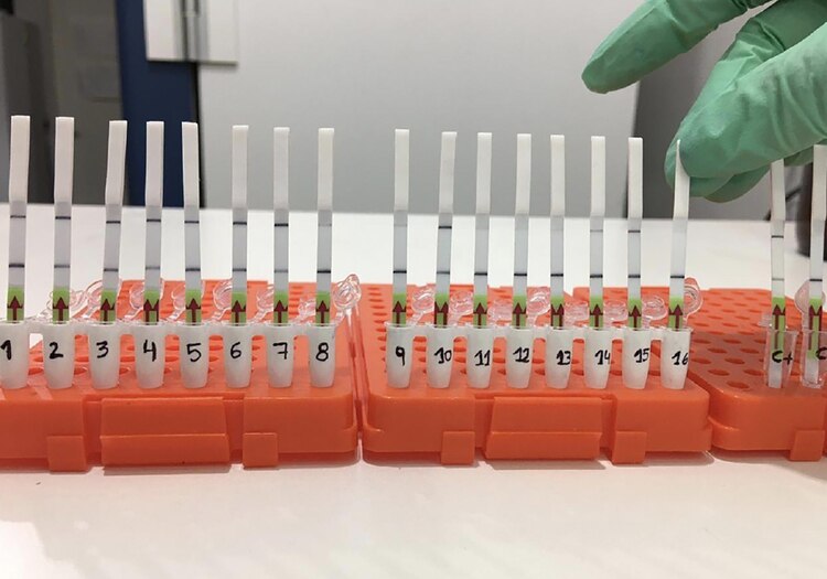 20 02 16 OP Científicos argentinos crearon un kit portátil para detectar el coronavirus en solo una hora 1 El Kit para detectar coronavirus en 60 minutos