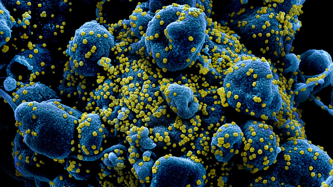 20 04 02 OP Cómo el coronavirus ataca células humanas 1 Una célula humana rodeada por SARS CoV 2. Imagen coloreada